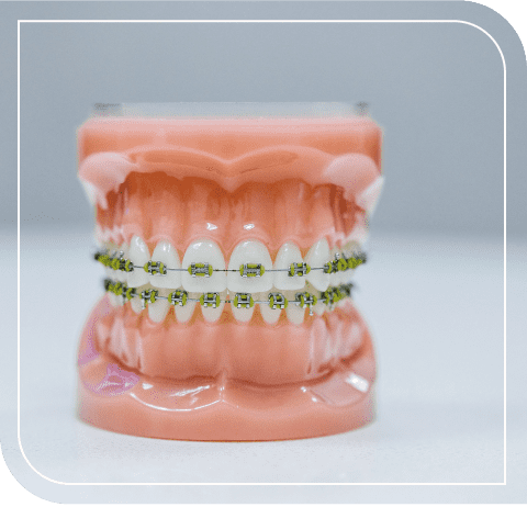Ортодонтия